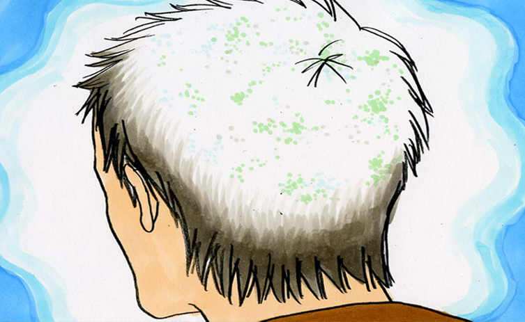 春日が語った、頭の上に白いカビが生えたという場面のイラスト。後頭部の髪を白く覆うものと、緑色の斑点が描かれている。